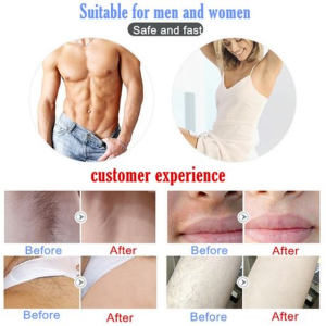Lescolton T009 IPL Laser Hair Remover - Image 4